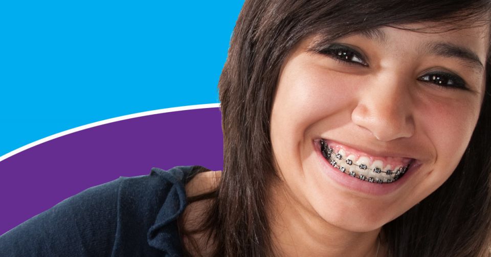 Why You Should Get Braces Early