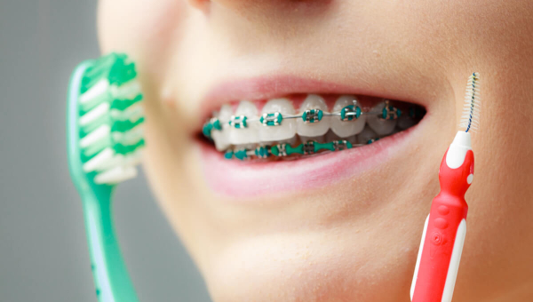 A patient with Houston braces poses with their toothbrush and interdental brushes that maintain their dental hygiene as advised by their Houston family dentist.