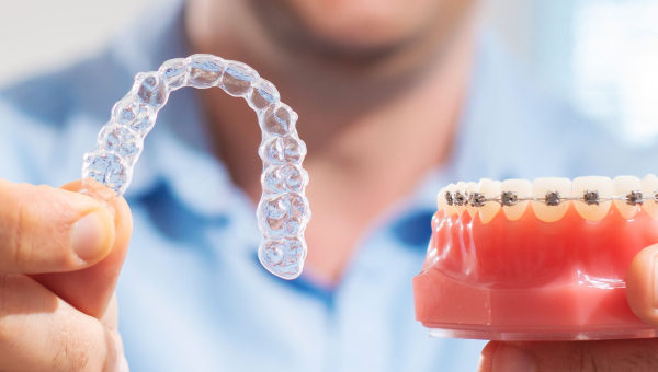 A comparison of Invisalign and metal braces
