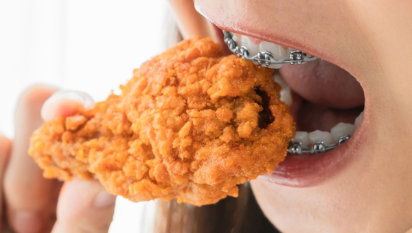A girl with braces eating chicken