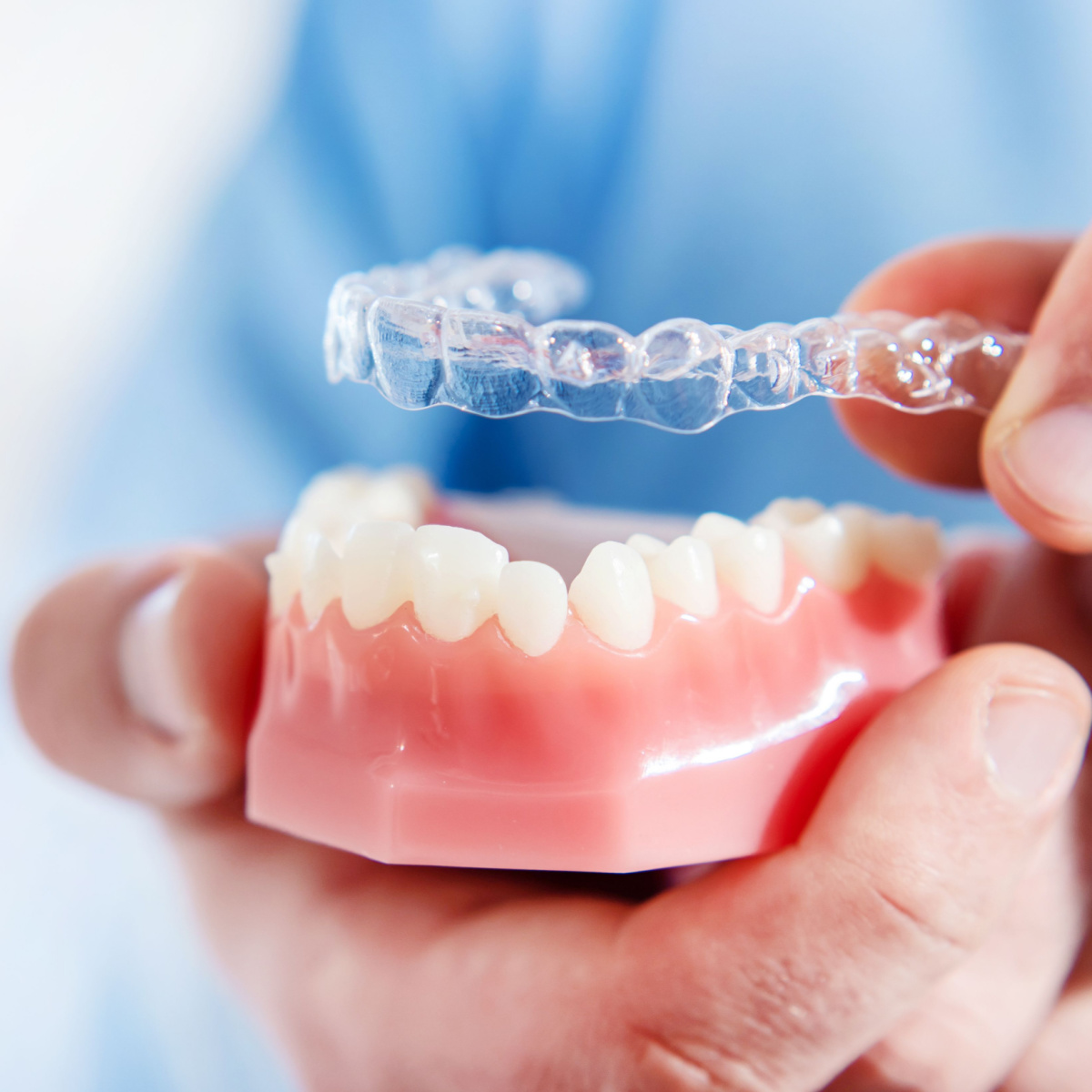 Who Is a Candidate for Houston Invisalign?