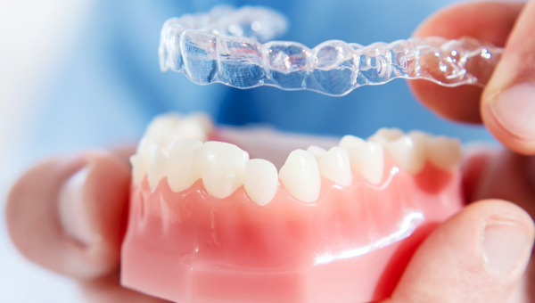 Houston Invisalign braces