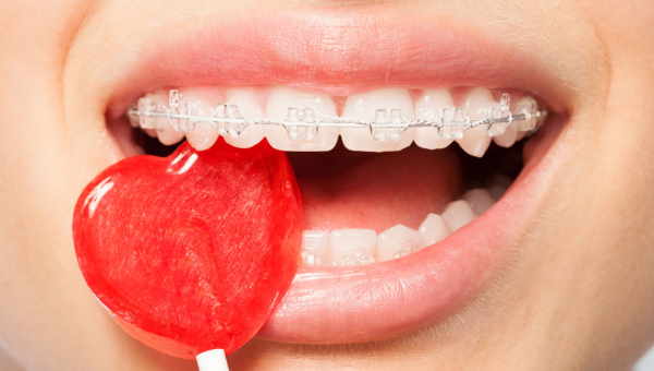 Girl with Houston braces carefully enjoys a candy.