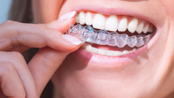 A woman putting on a retainer selected for her by her South Houston dentist to maintain her dental health after the removal of her South Houston braces.