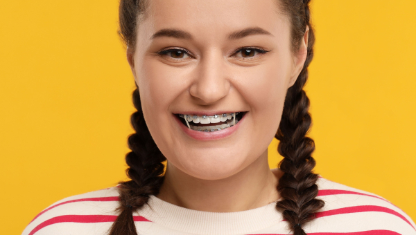 A girl wears her Houston braces with elastics.