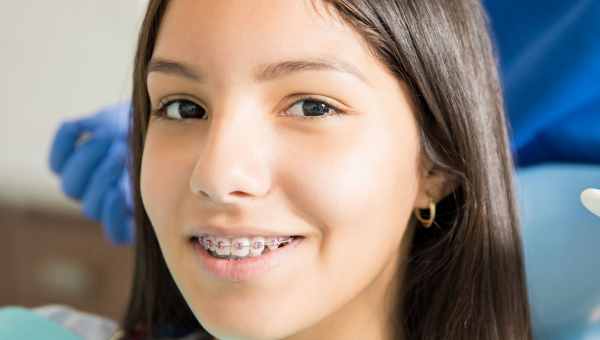 Here are some tips to make your first week with your South Houston braces comfortable.