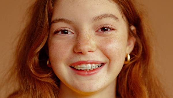 These conditions can be treated by an early Houston braces prescription.