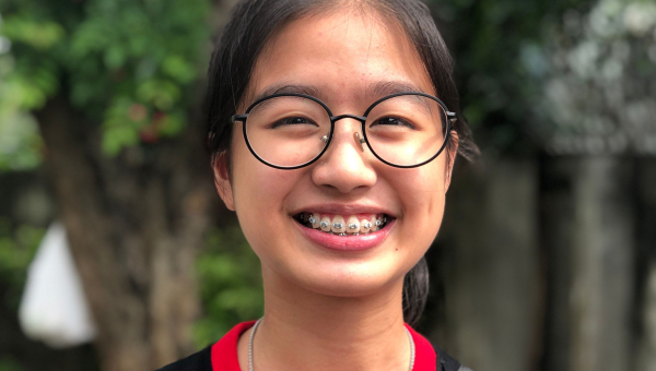 Here’s what you need to know about the length of your Houston braces treatment.