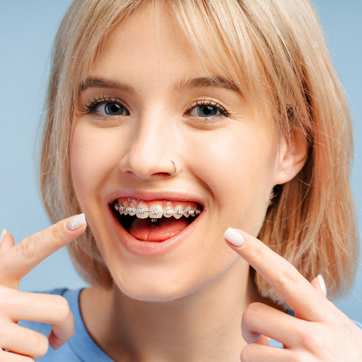 Understand how Houston braces can affect speech and chewing in the short term.