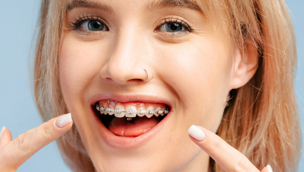 Understand how Houston braces can affect speech and chewing in the short term.