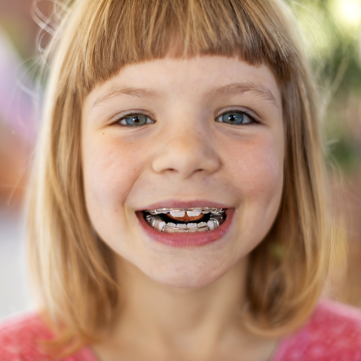 Consult your Houston dentist to determine the best age to get braces for your child.