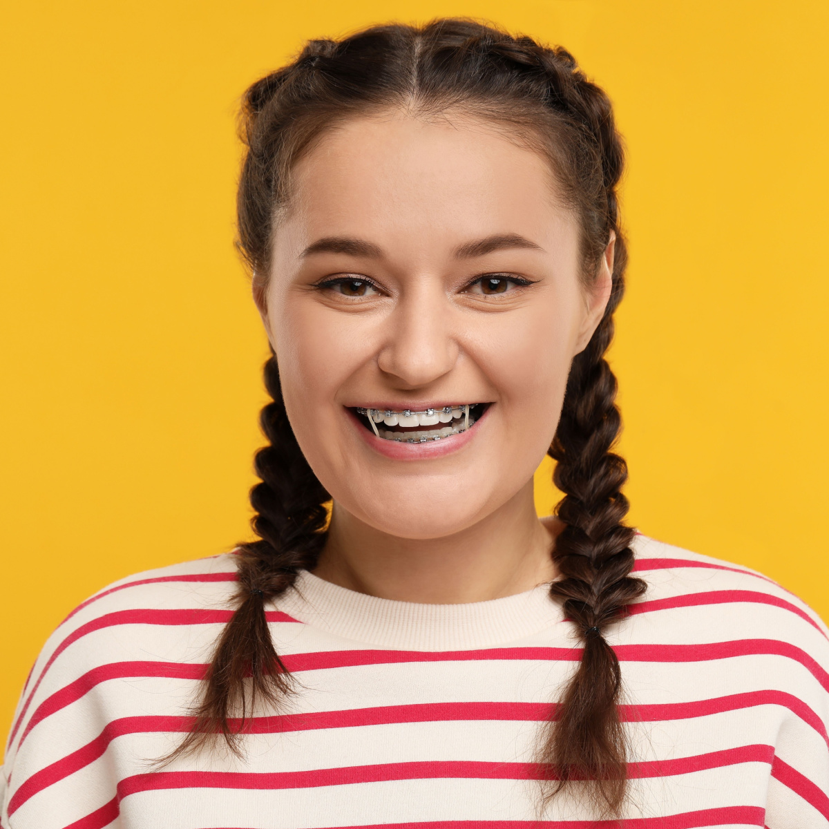 A girl wears her Houston braces with elastics.