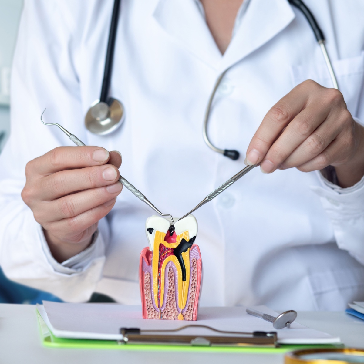 Anatomy of a root canal