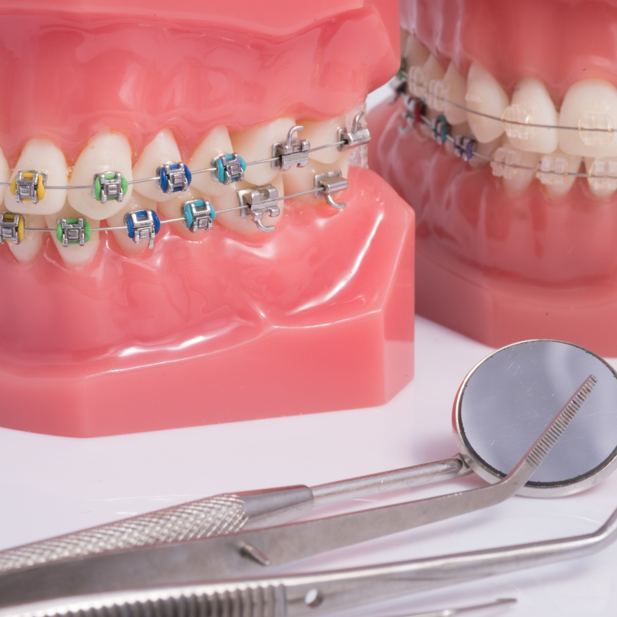 Ceramic vs metal braces