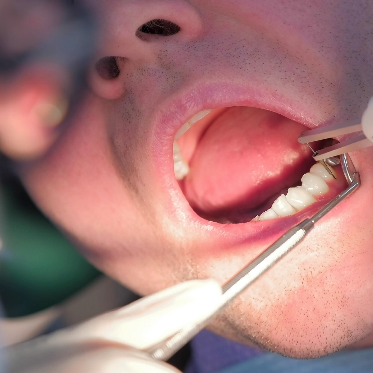 dentist examining gums of patient