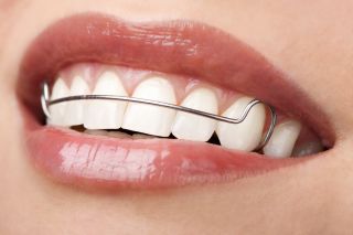 Wear Your Retainers After Houston Braces Treatment