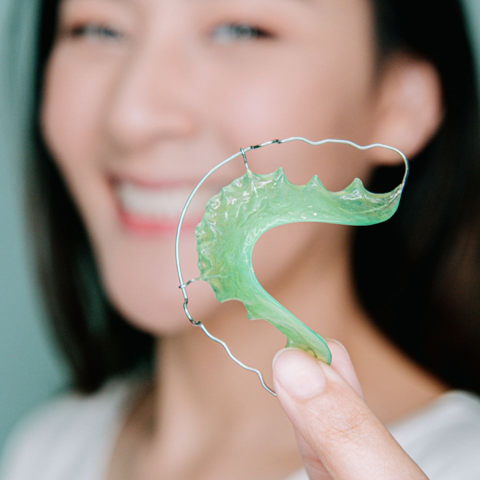 Why Do You Need Retainers After South Houston Braces Treatment?