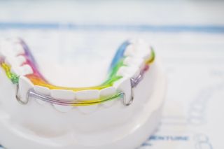 Pros and Cons of Traditional Orthodontic Retainers After Houston Braces