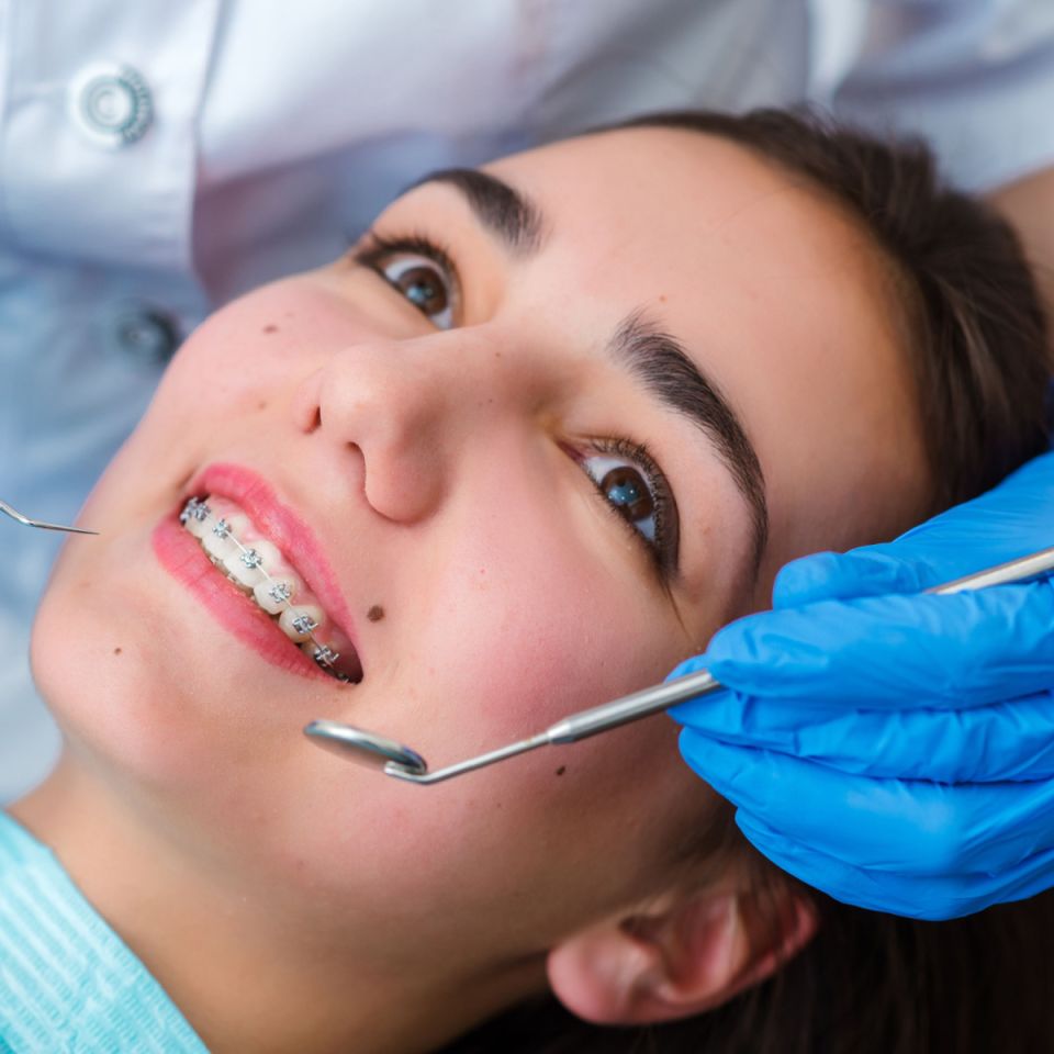Reasons to Consider Getting Houston Braces