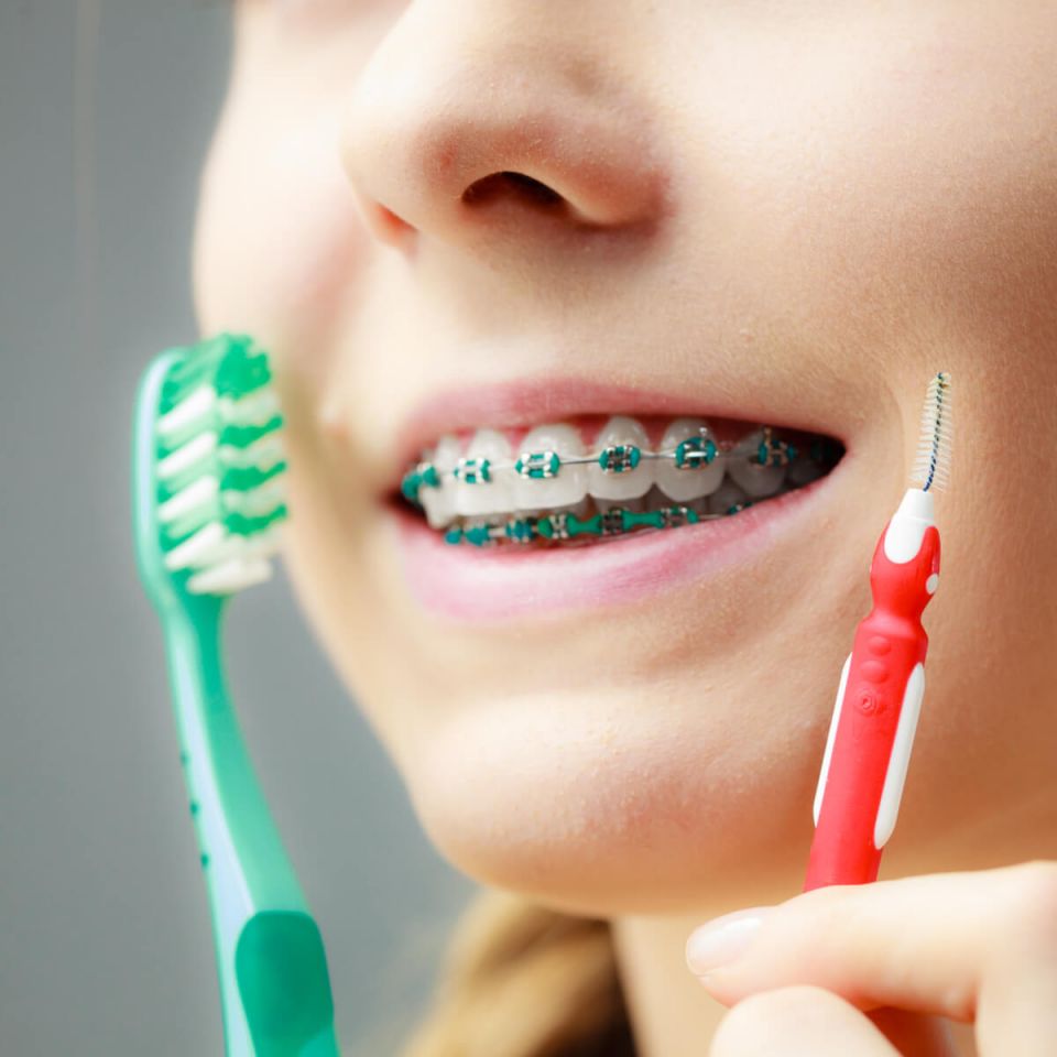 A patient with Houston braces poses with their toothbrush and interdental brushes that maintain their dental hygiene as advised by their Houston family dentist.