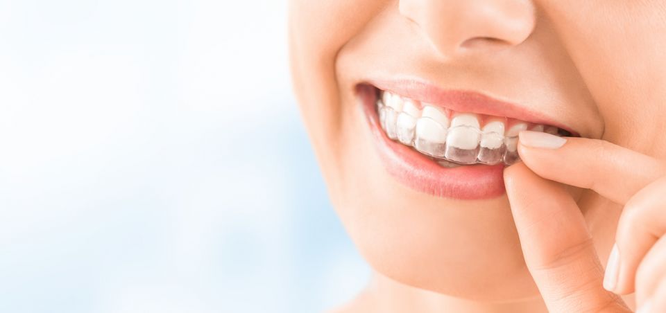 How To Keep Up Good Hygiene While Wearing Houston Invisalign