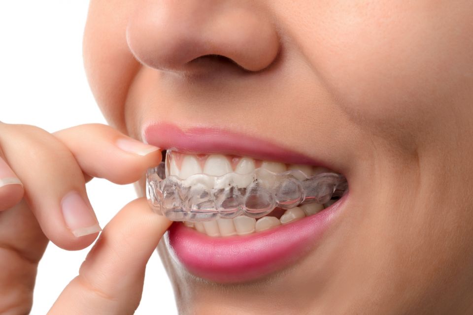 Wearing South Houston Invisalign Instead Of Metal Braces