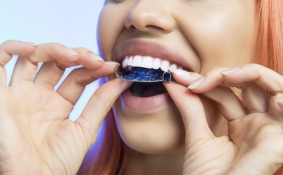 How To Care For A Hawley Retainer After Houston Braces