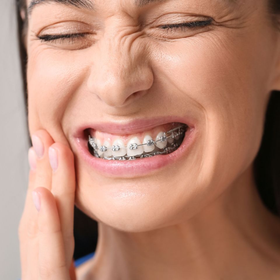 What to Do About South Houston Braces Pain
