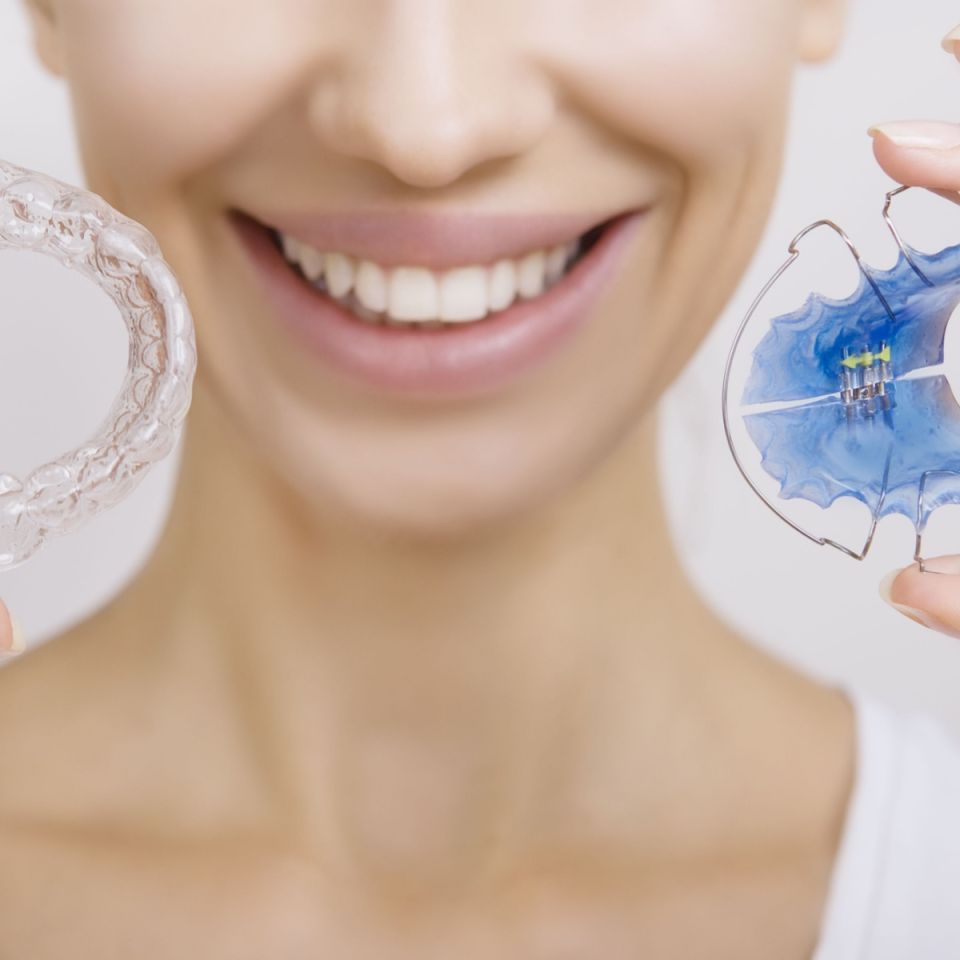 Does Every Houston Braces Patient Need a Retainer?