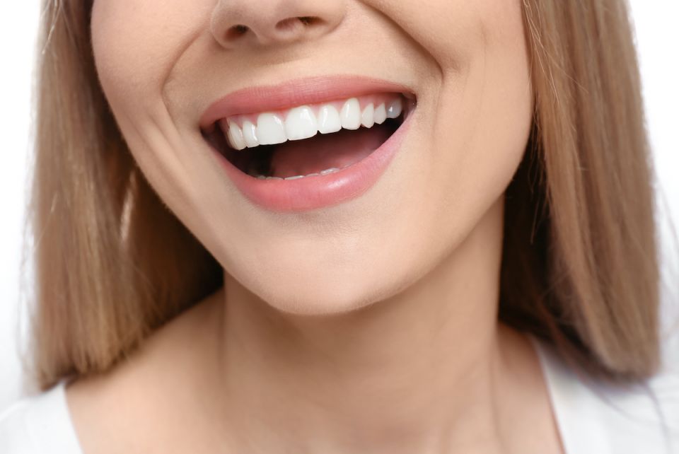 Do Houston Braces Permanently Straighten Your Teeth?