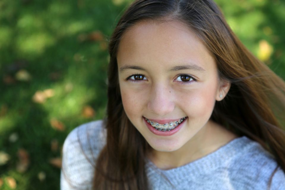 What is the Youngest Age at Which Your Child Can Get Houston Braces?