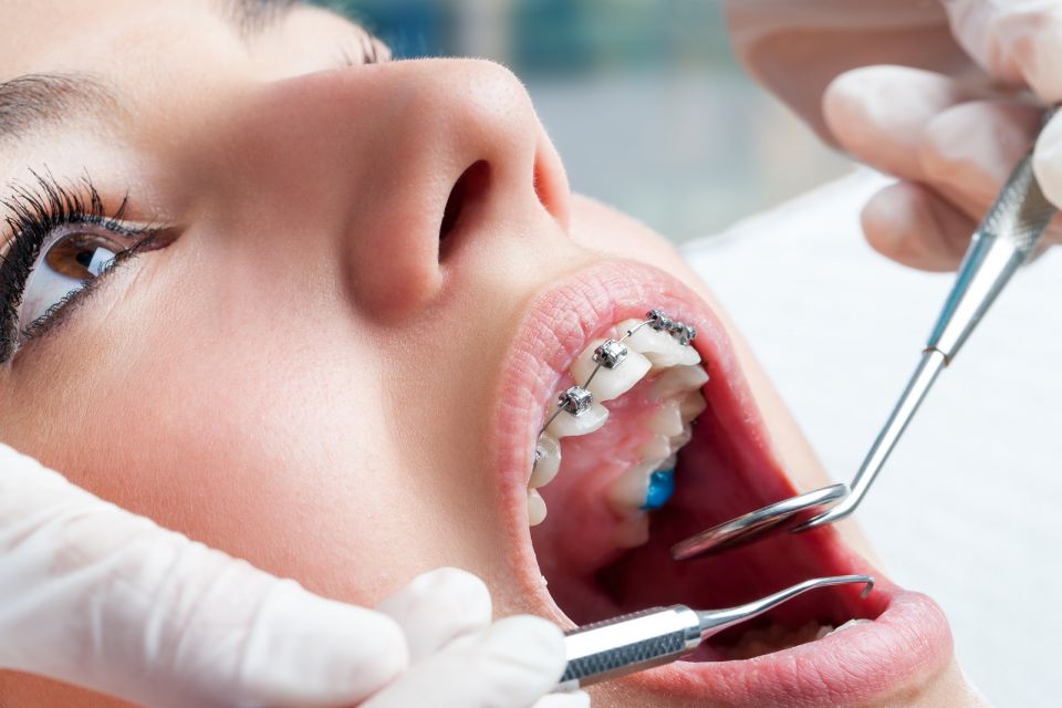 Early Orthodontics Affected by Lack of Dental Visits