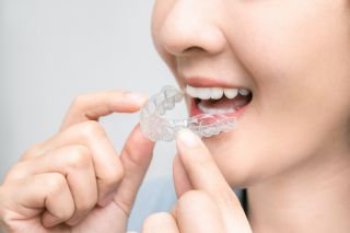 How South Houston Invisalign Works