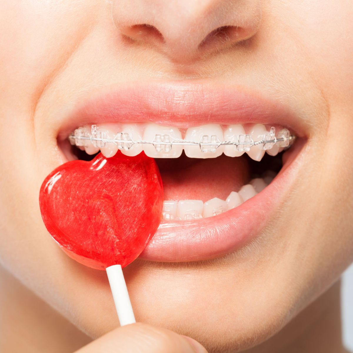 Girl with Houston braces carefully enjoys a candy.