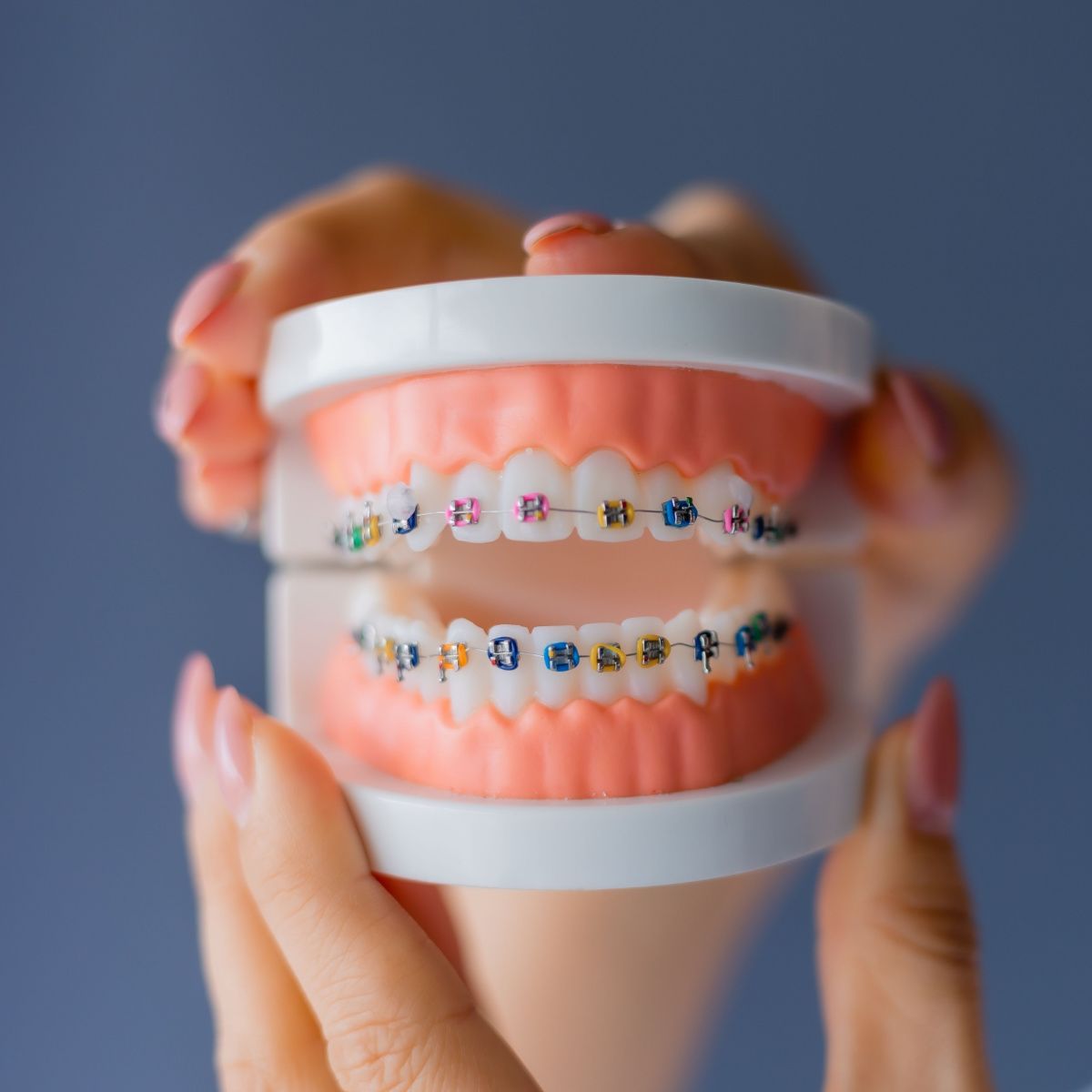 South Houston metal braces